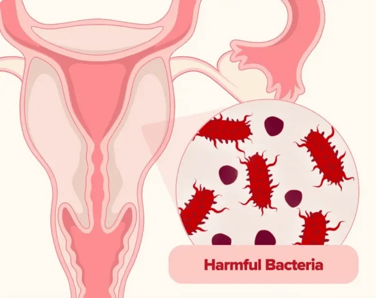 URO Probiótico vaginal